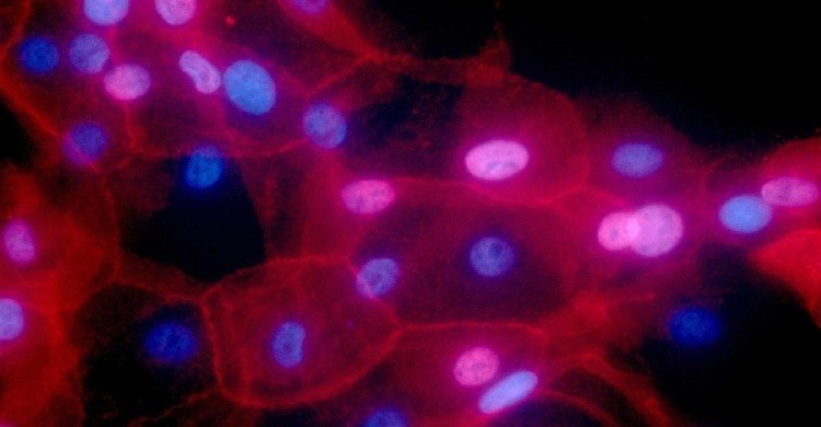 ক্যান্সার শনাক্ত ও চিকিৎসায় নতুন প্রযুক্তি