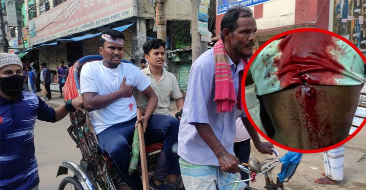 রায়সাহেব বাজারে গুলিতে আন্দোলনকারী জবির ৪ শিক্ষার্থী আহত