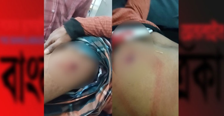 নোয়াখালীতে প্রকাশ্যে যুবদল কর্মীকে গুলি করে পালালেন অস্ত্রধারীরা
