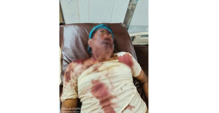 সিলেটে জমি নিয়ে বিরোধ: ছোট ভাইয়ের উপর বড় ভাইয়ের হামলা, আহত ৫