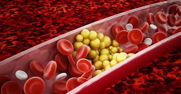 মাত্র ২০ দিনেই কোলেস্টেরল কমানোর ৬টি সহজ উপায়