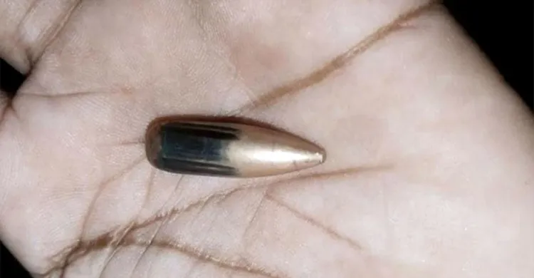 টেকনাফ সীমান্তে মিয়ানমারের গুলিতে নারী আহত