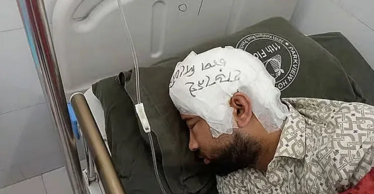 চট্টগ্রাম বিশ্ববিদ্যালয়ে সংঘর্ষে আহত মামুনের মাথায় সফলভাবে খুলি প্রতিস্থাপন