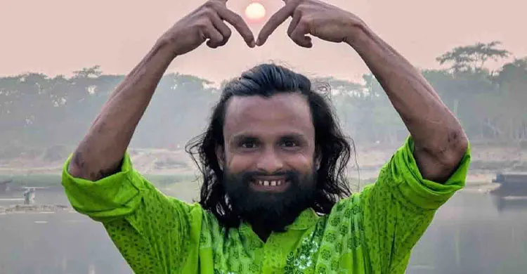 পেট্রোল দিয়ে কনটেন্ট বানাতে গিয়ে দগ্ধ কনটেন্ট ক্রিয়েটর আল-আমিন