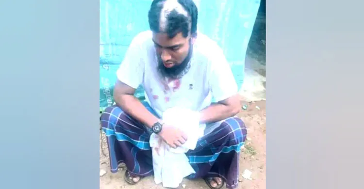 জৈন্তাপুরে কিশোর বলাৎকারের ঘটনায় কবিরাজের বিরুদ্ধে মামলা