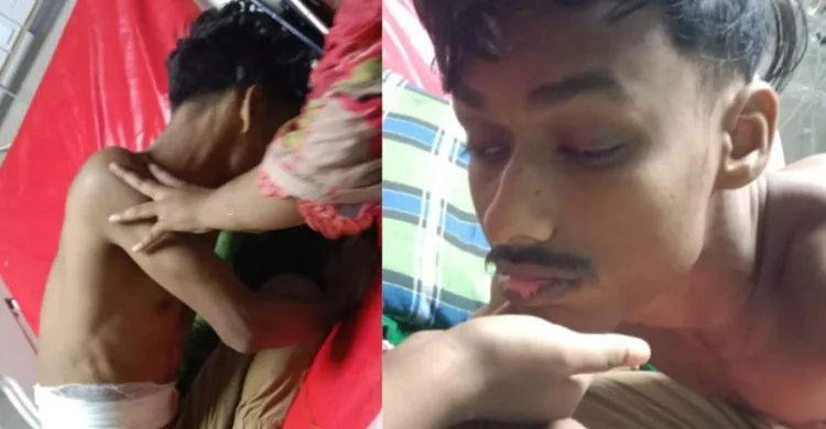 বগুড়ায় এক যুবক গুলিবিদ্ধ