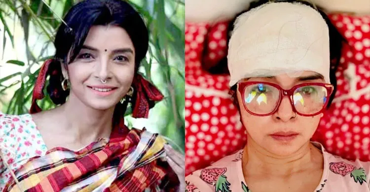 সড়ক দুর্ঘটনায় গুরুতর আহত এলিনা শাম্মী, ১৫টি সেলাই